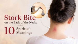 Stork Bite Back of Neck Spiritual Meaning